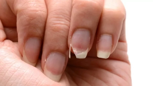 How Long Does It Take For Nails To Grow Back? Surprising Nail Growth Factors Here!