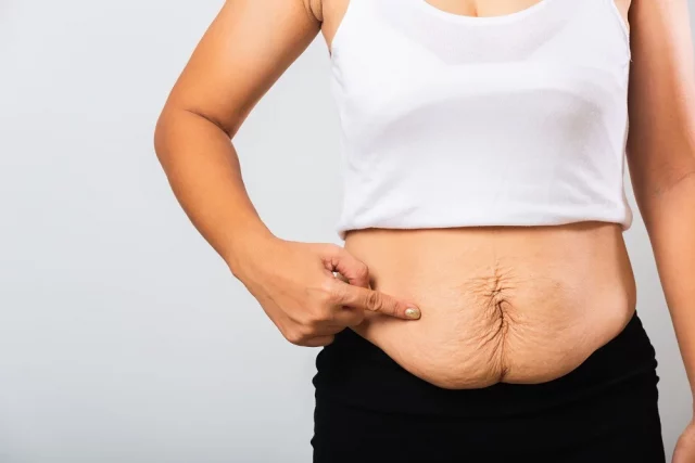 How To Tell The Difference Between Fat And Loose Skin? Why Does It Matter? 