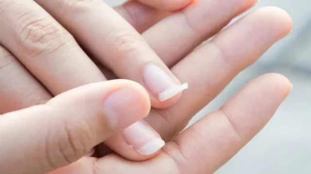 How Long Does It Take For Nails To Grow Back? Surprising Nail Growth Factors Here!